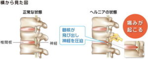 イラスト