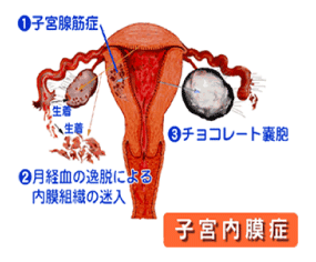 図解