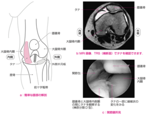 解剖