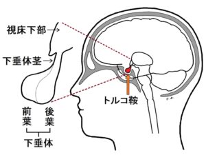 図解