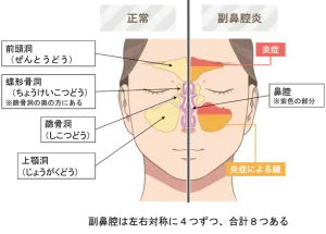 イラスト